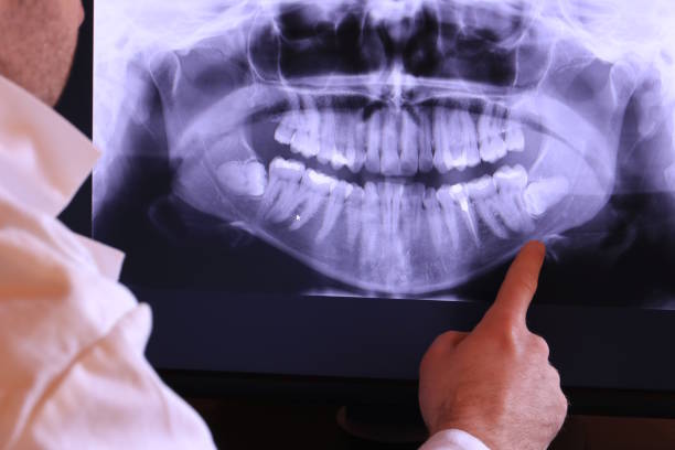 Best Emergency Dentist for Knocked-Out Tooth in Compo, CT