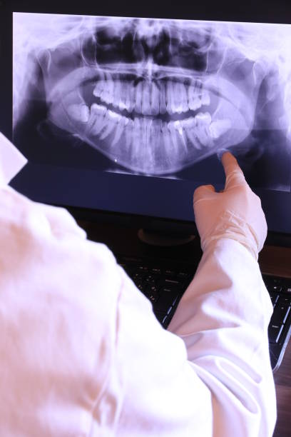 Best Broken or Cracked Tooth Emergency Dentist in Compo, CT