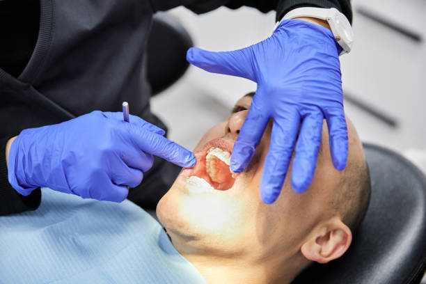 Best Emergency Dentist for Knocked-Out Tooth in Compo, CT